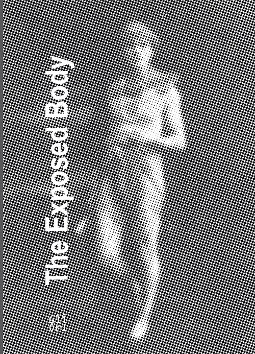 The exposed body