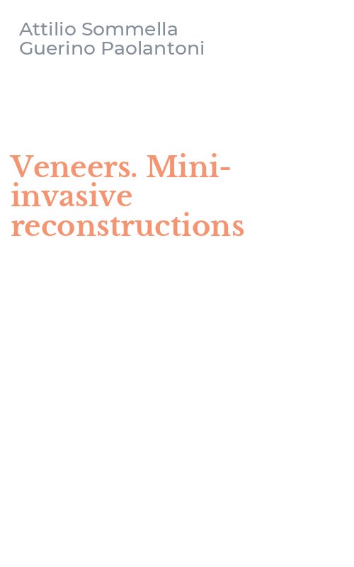 Veneers. Mini-invasive reconstructions