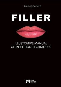 Filler. Illustrative manual of injection techniques