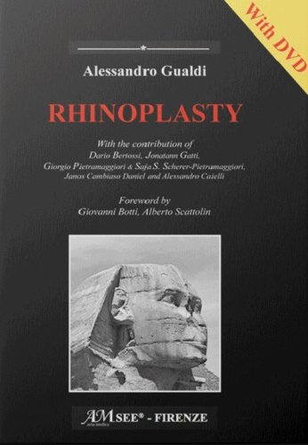 Rhinoplasty