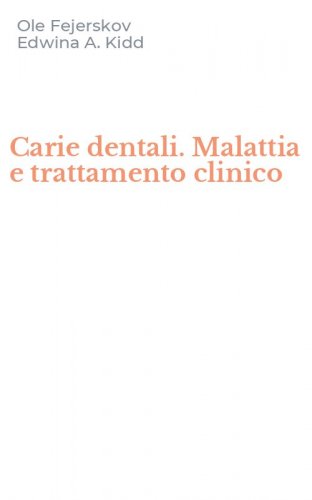 Carie dentali. Malattia e trattamento clinico