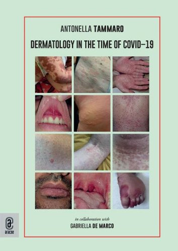 Dermatology in the time of Covid-19