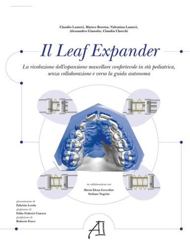 Il Leaf Expander. La rivoluzione dell'espansione mascellare confortevole in et&agrave; pediatrica senza collaborazione e verso la guida autonoma