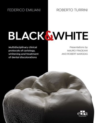 Black&White. Multidisciplinary clinical protocols of cariology, whitening and treatment of dental discolorations