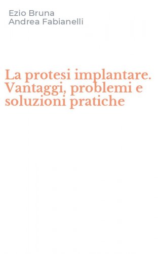 La protesi implantare. Vantaggi, problemi e soluzioni pratiche