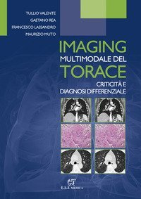 Imaging multimodale del torace. Criticit&agrave; e diagnosi differenziale