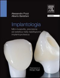Implantologia. Mini-invasivit&agrave;, precisione ed estetica nella riabilitazione implantoprotesica