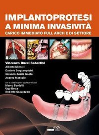 Implantoprotesi a minima invasivit&agrave;. Carico immediato full arch e di settore