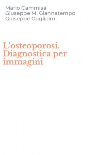 L'osteoporosi. Diagnostica per immagini