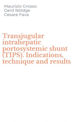 Transjugular intrahepatic portosystemic shunt (TIPS). Indications, technique and results