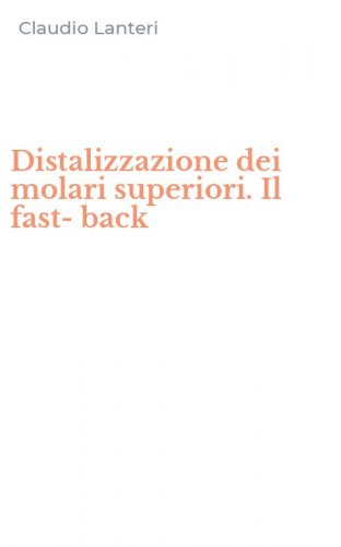 Distalizzazione dei molari superiori. Il fast-back