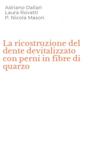 La ricostruzione del dente devitalizzato con perni in fibre di quarzo