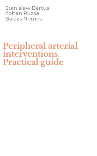 Peripheral arterial interventions. Practical guide