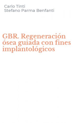 GBR. Regeneraci&oacute;n &oacute;sea guiada con fines implantol&oacute;gicos