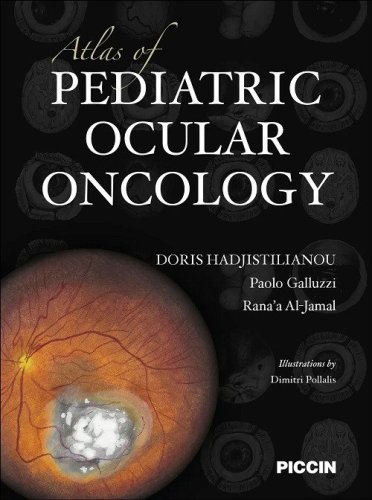 Atlas of pediatric ocular oncology