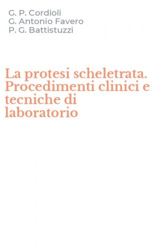 La protesi scheletrata. Procedimenti clinici e tecniche di laboratorio