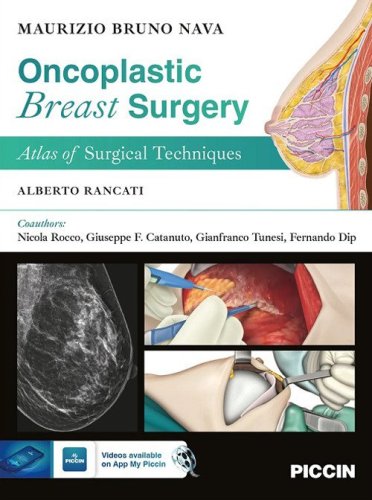 Oncoplastic breast surgery. Atlas of surgical techniques
