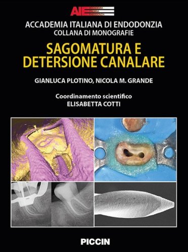 Sagomatura e detersione canalare