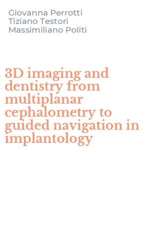 3D imaging and dentistry from multiplanar cephalometry to guided navigation in implantology