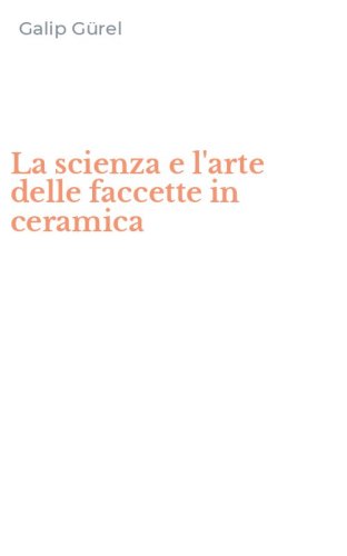 La scienza e l'arte delle faccette in ceramica