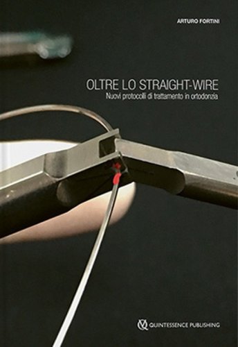 Oltre lo straight-wire. Nuovi protocolli di trattamento in ortodonzia