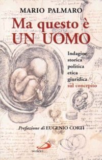 Ma questo &egrave; un uomo. Indagine storica, politica, etica, giuridica sul concepito