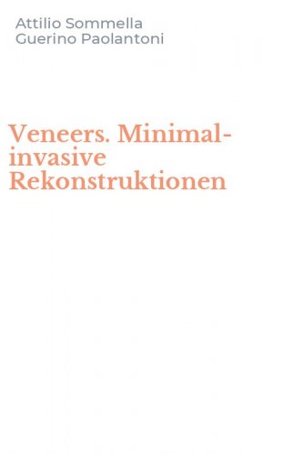 Veneers. Minimal-invasive Rekonstruktionen