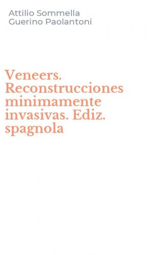 Veneers. Reconstrucciones minimamente invasivas. Ediz. spagnola
