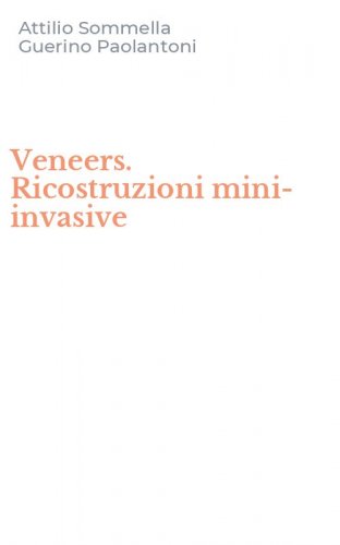 Veneers. Ricostruzioni mini-invasive