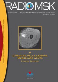 L'imaging della lesione muscolare acuta