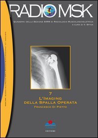 L'imaging della spalla operata. MSK