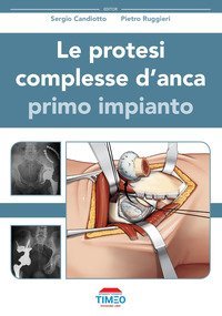Le protesi complesse d'anca. Primo impianto
