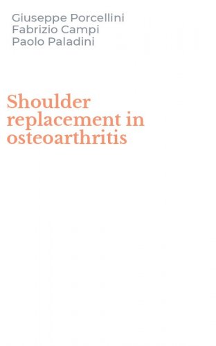 Shoulder replacement in osteoarthritis