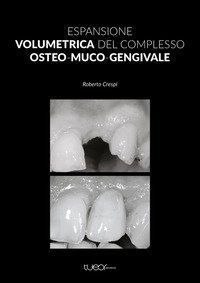 Espansione volumetrica del complesso osteo-muco-gengivale