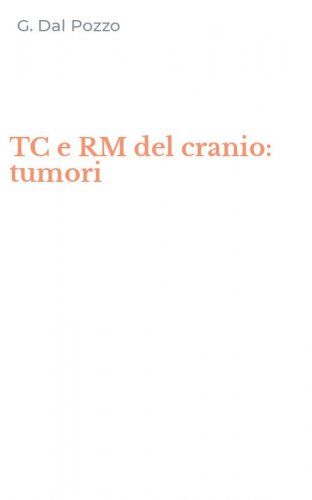 TC e RM del cranio: tumori