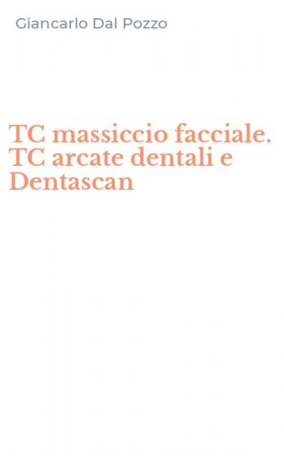 TC massiccio facciale. TC arcate dentali e Dentascan